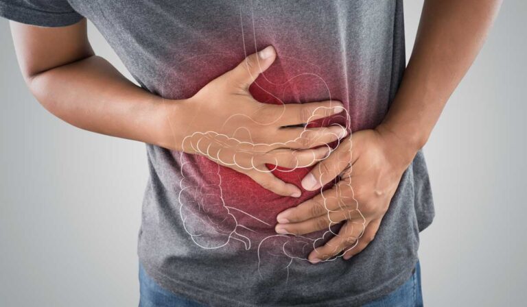 Colitis, padecimiento frecuente.